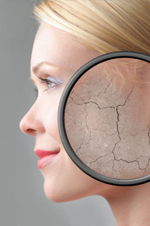 IDUN CBD moisturizer. Skin cream for optimal hydration with the power of cannabis plant. Without THC. Vegan. 14 Dry skin requires special care.