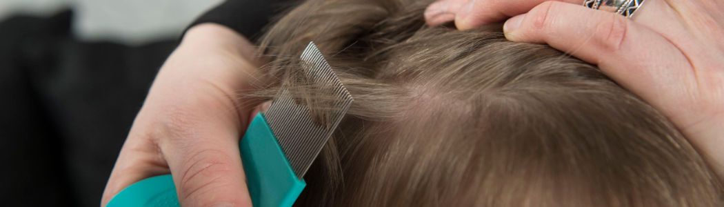 Itching on the head and white, sticky "dandruff" are often an indication of lice.